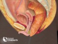 Surgical Treatment Of Recto Vestibular Fistula Cincinnati Children S