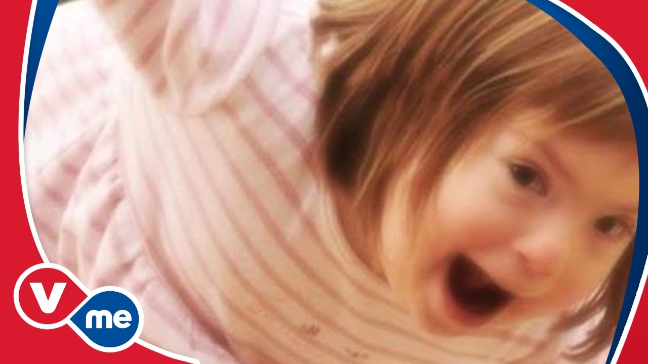 TuBebé | ¿Cómo Tratar a un Hijo con Síndrome de Down