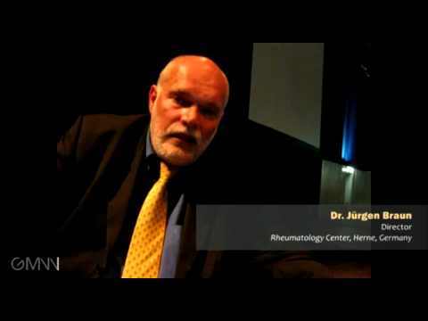 TNF inhibitors for Ankylosing Spondylitis