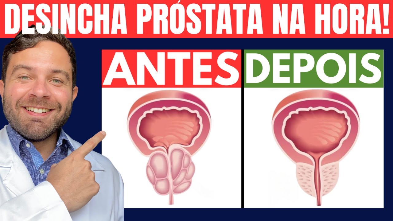Just ONE SPOON to REDUCE SWELLING OF ENLARGED PROSTATE | Natural Remedy for Swollen Prostate