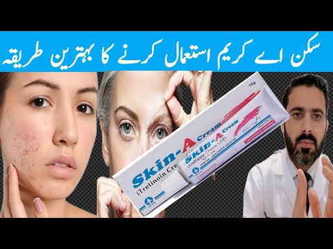 Skin A cream (Tretinoin ) how to use ? Skin A cream Uses and Side Effects