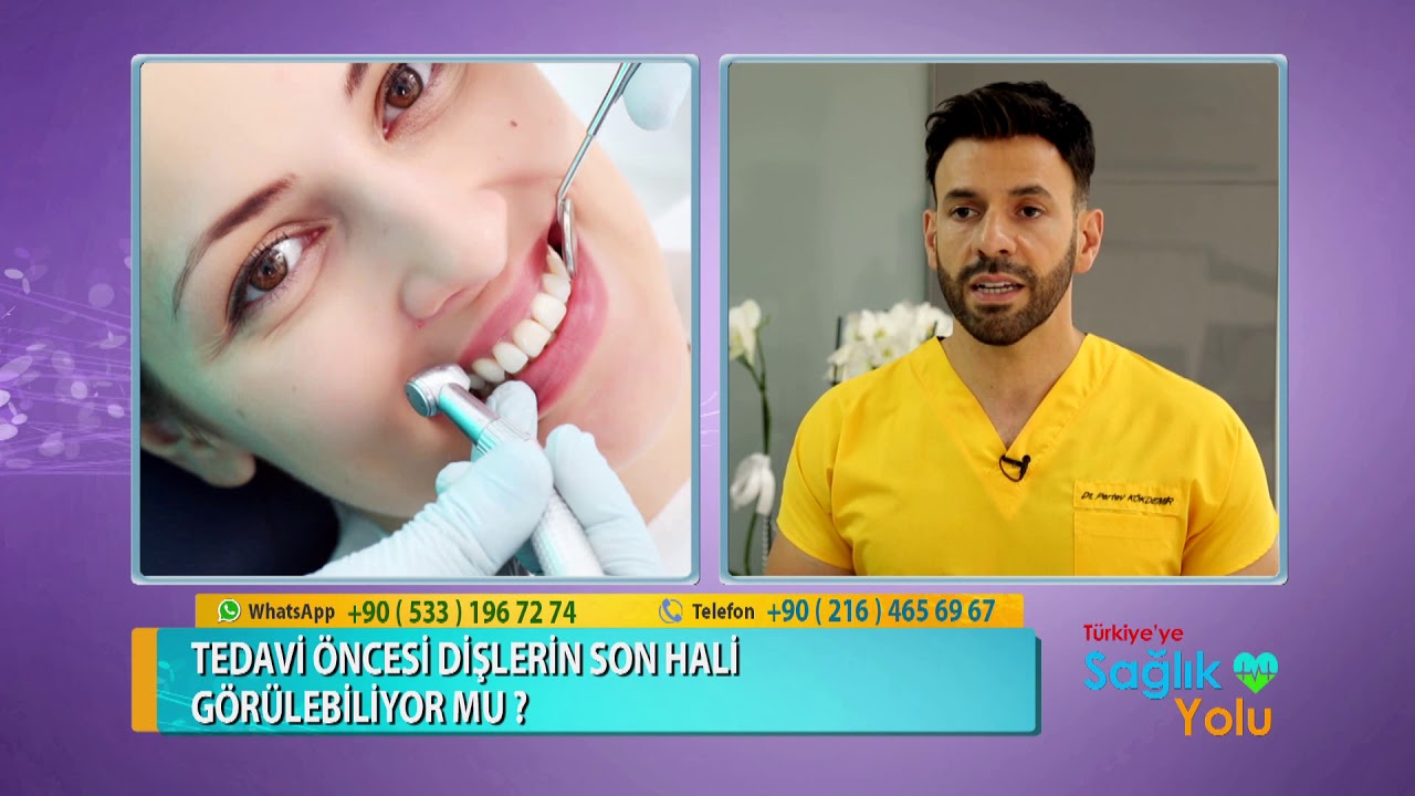 Diş Estetiğinde Uygulanan Yöntemler