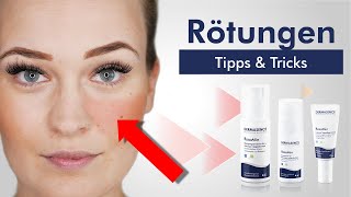 Tipps bei Rötungen im Gesicht | Schluss mit Rosacea!