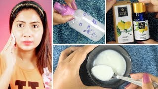 Top 5 Uses of Lemon Essential Oil | Skin Brightening, Pigmentation, Acne | How To Use Essential Oils