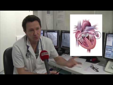 Pression admissible pour le sang humain Lhypertension et au sud