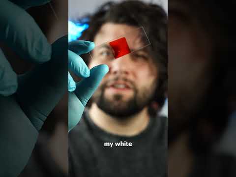 White Blood Cell VS Still Water Microbes!