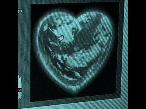 (free) hyperpop x crystal castles x synthpunk type beat ”raven” | prod. morecalcium