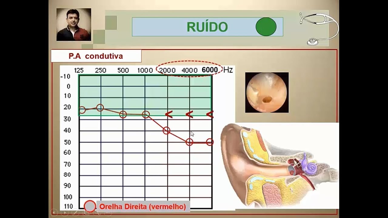 Videoaula - 8 Parte 2 - Riscos físicos RUÍDO -- PAIRO