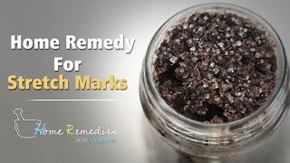 Home Remedy For Stretch Marks | How To Get Rid Of Stretch Marks | how to remove stretch marks