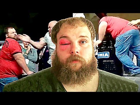 ⬛ ЧЕМПИОНАТ ПО ПОЩЕЧИНАМ. ПЕЛЬМЕНЯ ВЫРУБИЛИ / SLAPPING CHAMPIONSHIP