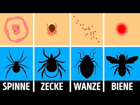 Wie man einen Insektenbiss identifiziert und richtig behandelt