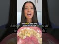 Dental Tartar Vs Dental Plaque Shorts