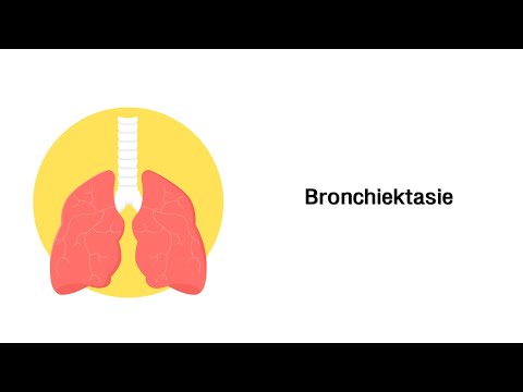 Bronchiektasen - Erkrankungen der Atemwege
