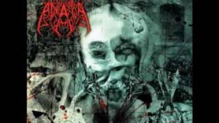 Anata - A Problem Yet To Be Solved