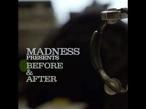 Madness | Before And After