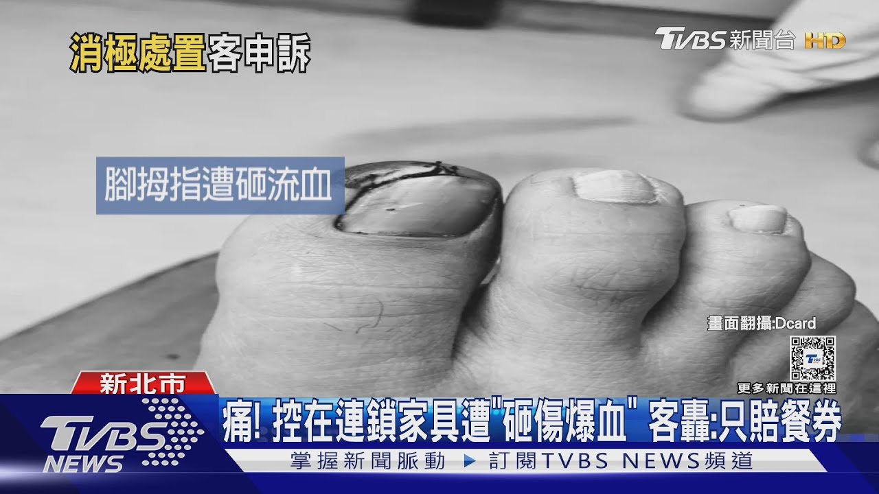 痛!控在連鎖家具遭「砸傷爆血」 客轟:只賠餐券