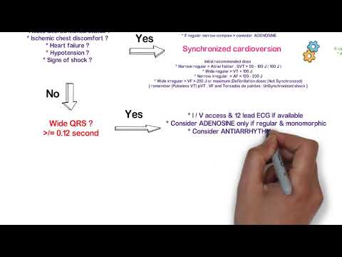 Tachycardia algorithm adult and paediatrics in one flow chart. ACLS, PALS,  cascade saadman