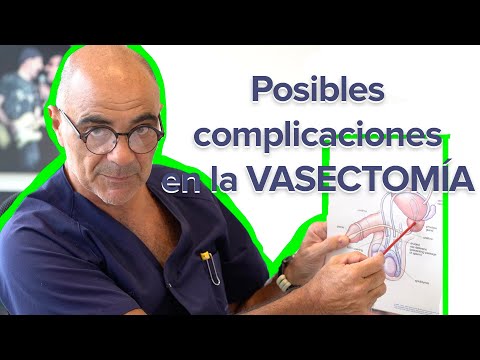 Cómo signar Vasectomía en LSE