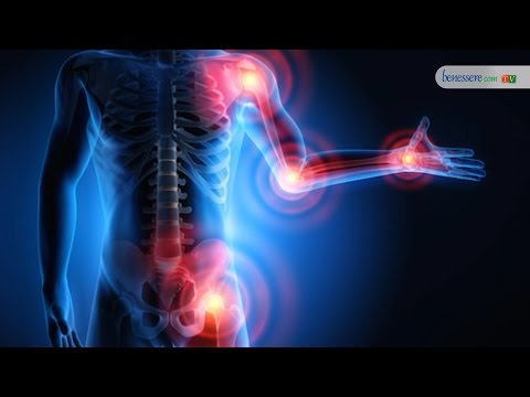 Mal di gamba anca quale medico Iniezioni di acido ialuronico nelle articolazioni prezzi