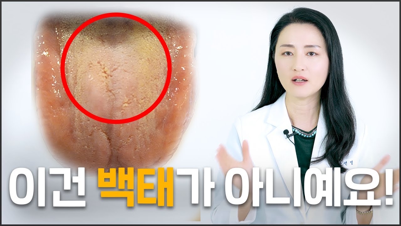 [유튜브 영상]