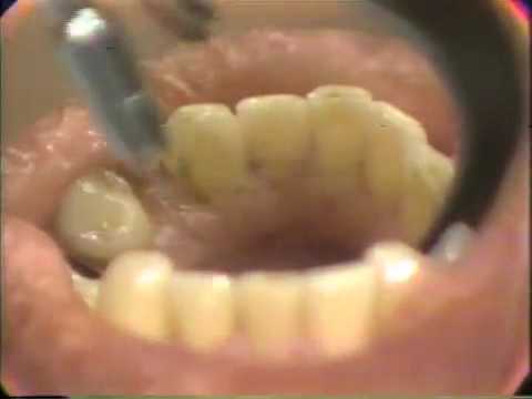 Human papillomavirus hpv in throat