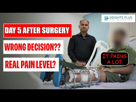 Limb lengthening surgery Day 5 | Surgery for height increase