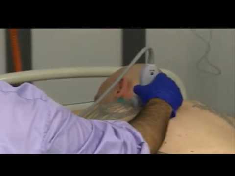 Tutorial Paravertebral Block Dr Mk Varma