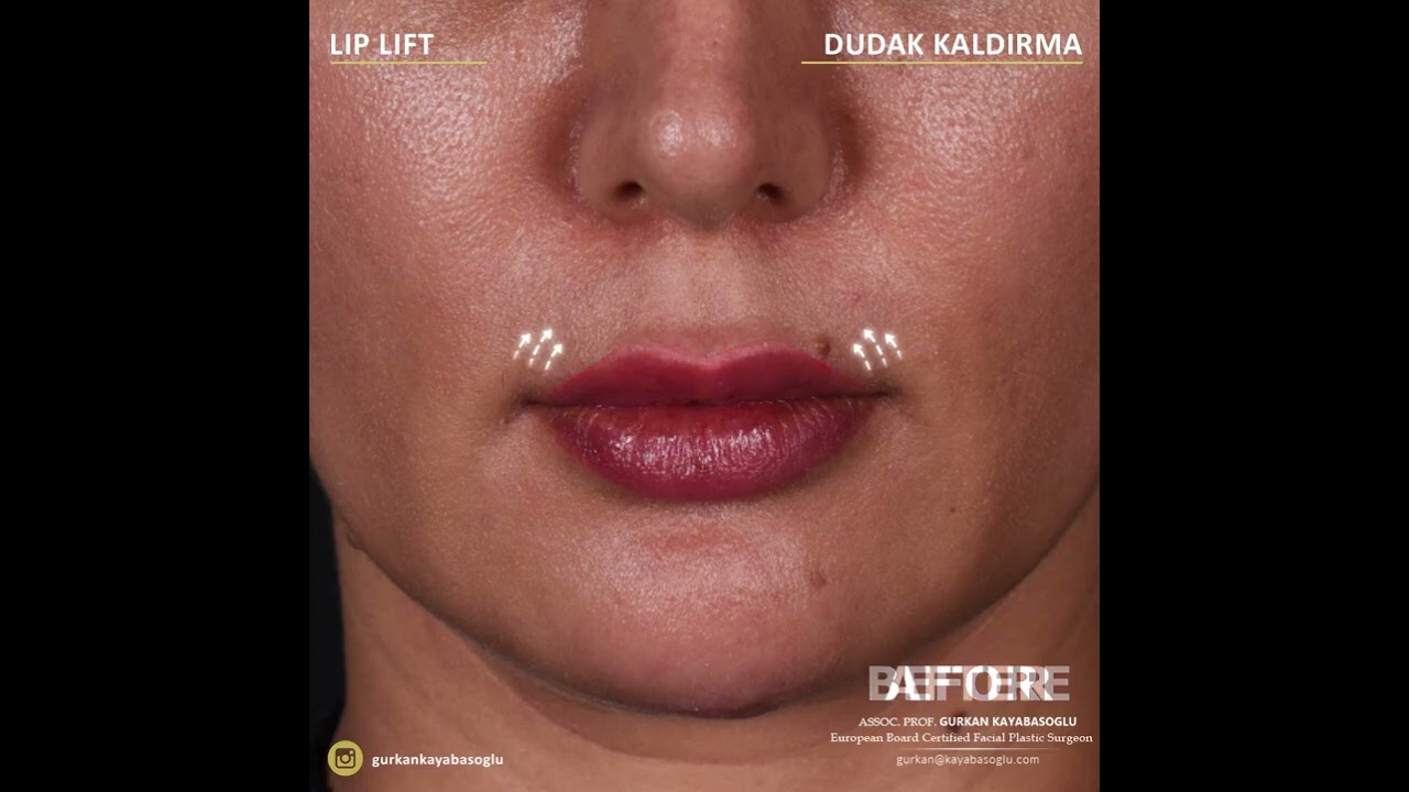 Dr Gurkan Kayabasouglu Plastic Surgeon in Istanbul, Turkey
