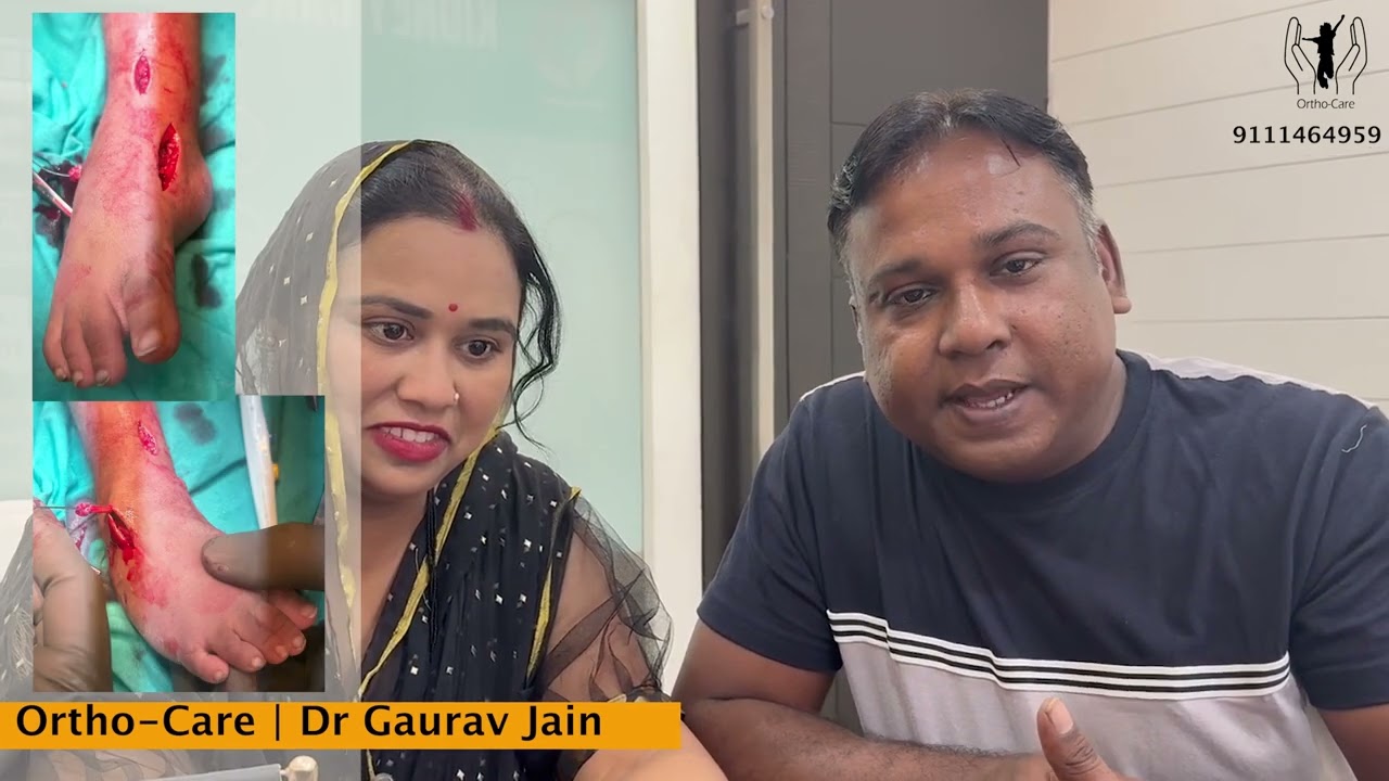 Clubfoot treatment results by Dr Gaurav Jain