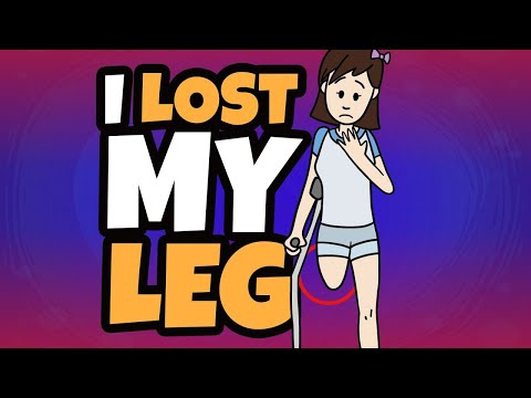 I Lost My Leg Tragically At An Early Age
