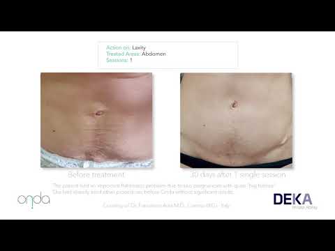 Onda Clinical Cases Slide Show