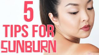How to Get Rid of Peeling Skin after Sunburn | How to Get Rid of Peeling Skin on Face From Sunburn