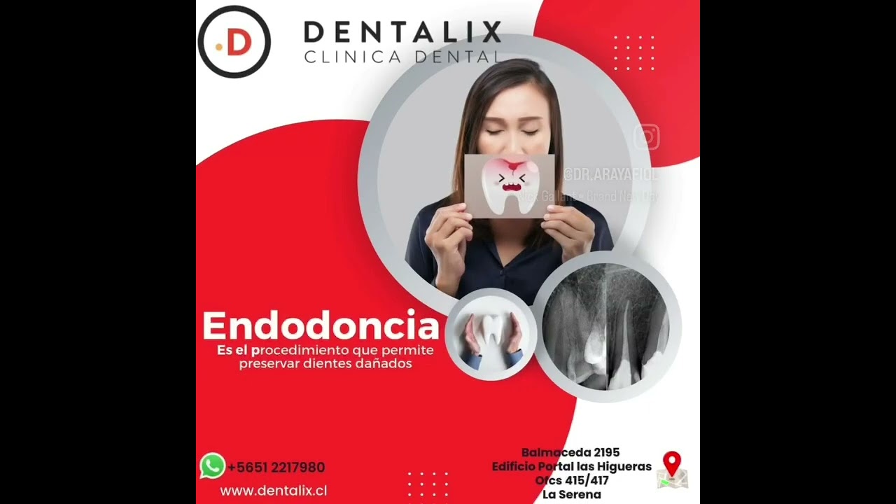 Javier Araya Fiol-27