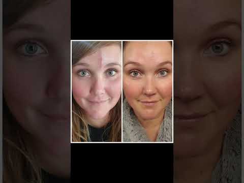 Bálsamo de elemento curativo de capim-limão para spa