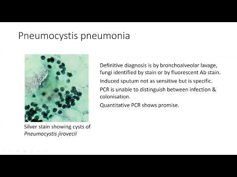 Approach to Respiratory Opportunistic Infections in Patients with HIV - Gary Maartens