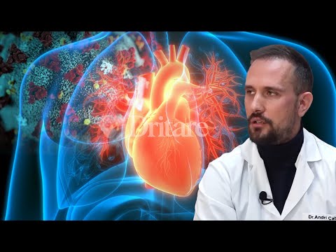 Çfarë tregon aritmia për shëndetin e zemrës! Flet kardiologu! | Dritarja e Doktorit