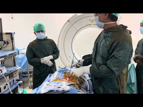 Endoscopic spine surgery using Neuro navigation : Precision accuracy safety small cut fast recovery