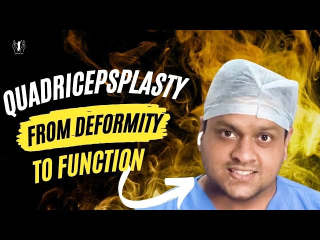 Quadricepsplasty Surgery by Dr. Gaurav Jain Indore