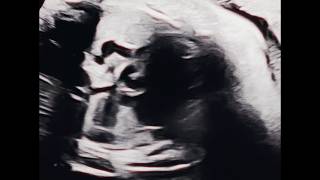 Lirik Lagu Can I Tell The World I Love You? - Adikara: Hope You'll Hear This One Day