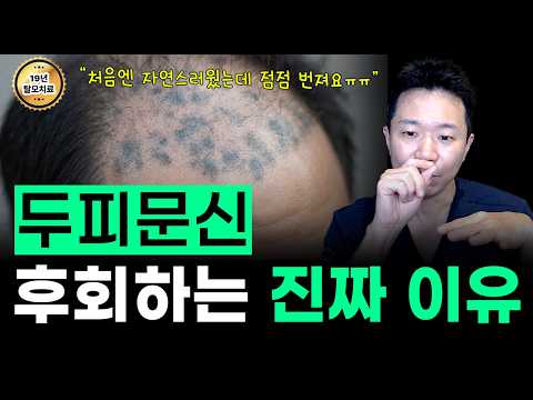 두피 문신 하면 탈모 더 심해지나요? 백발 두피문신의 진실, 의사가 답하는 두피 문신(SMP) 부작용의 진실 | 번짐, 모낭 손상, 염증 설명