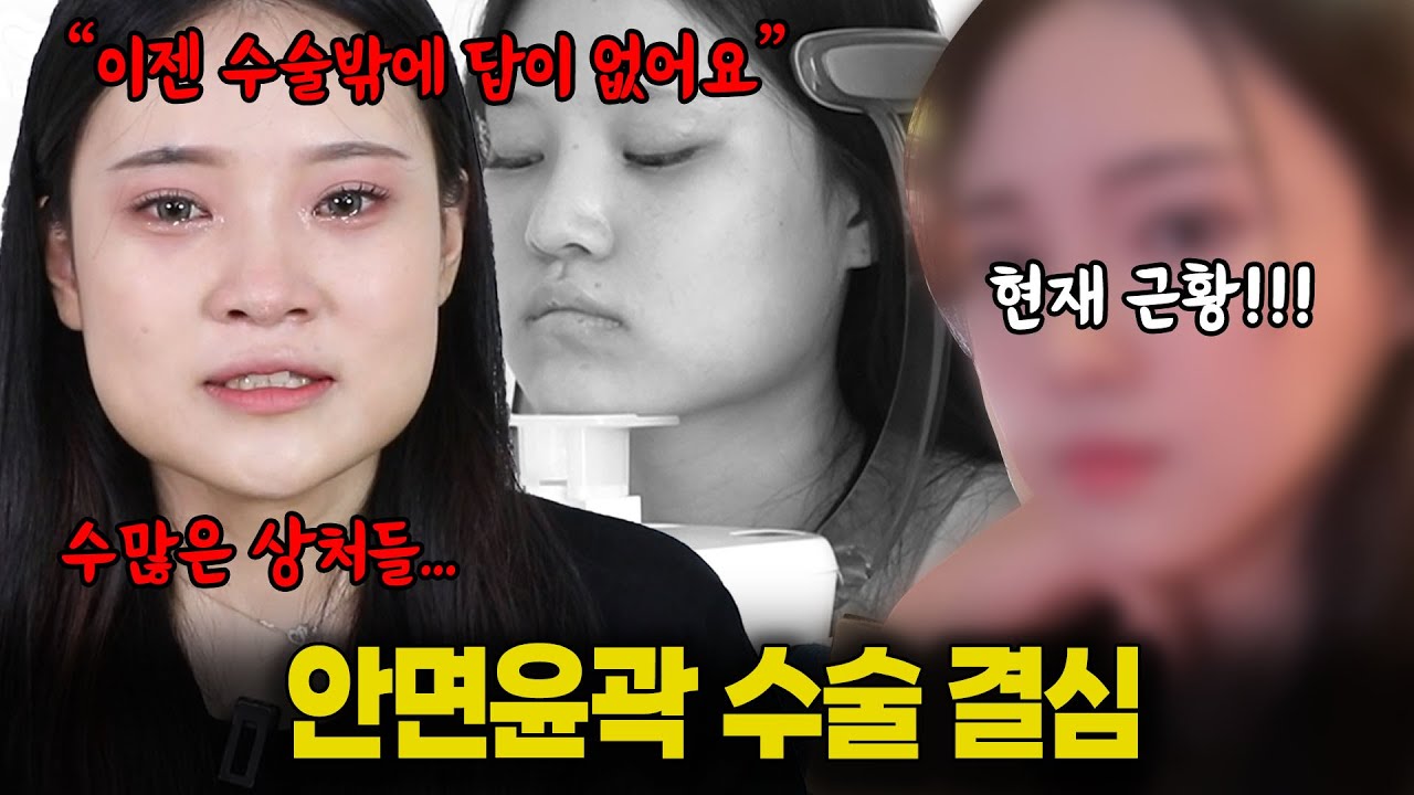 I am Detailist - 바노바기성형외과의원 브이로그 I Am Detailist - 바노바기성형외과의원 브이로그