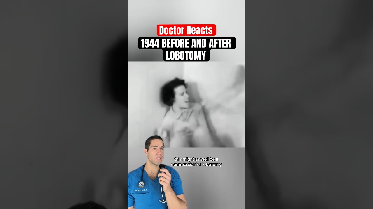 Doctor Reacts: lobotomy before and after