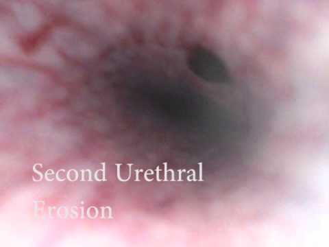 Equine Endoscopy of Urethra