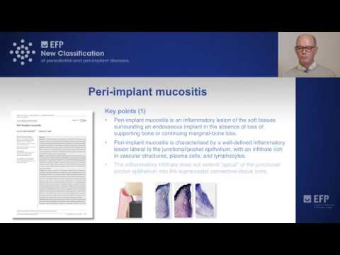 Peri-Implant Mucositis