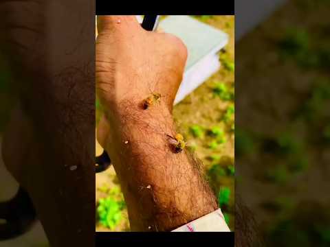 , title : 'Bee Sting First Aid: What to Do and What to Avoid #viral #shorts'