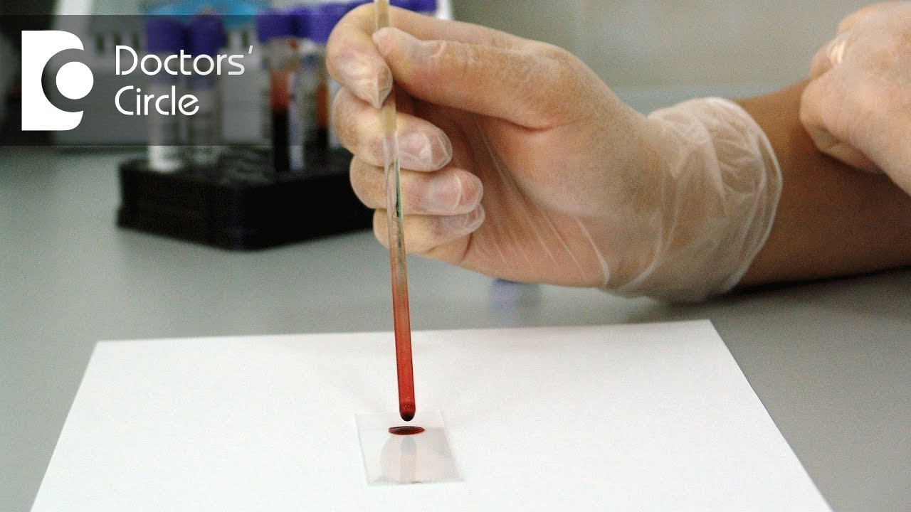 Can someone with HIV & undetectable viral load pass HIV to someone else - Dr. Ramakrishna Prasad