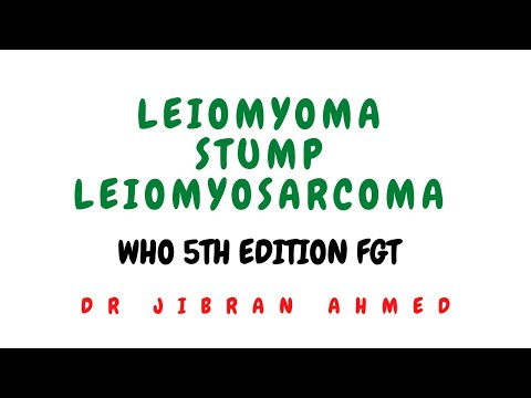 ENDOMETRIAL CARCINOMA II FEMALE GENITAL TRACT II ROBBINS 10TH E II PATHOLOGY LECTURE