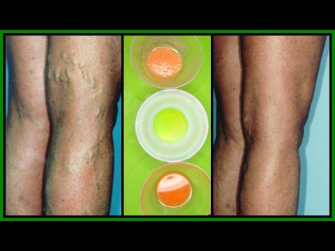 Trucco per lentiggini video Ho tutto il corpo in lentiggini per toglierli
