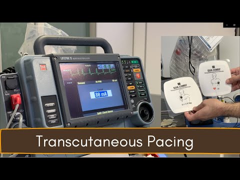 Crash Cart 04: Transcutaneous Pacing (TCP)