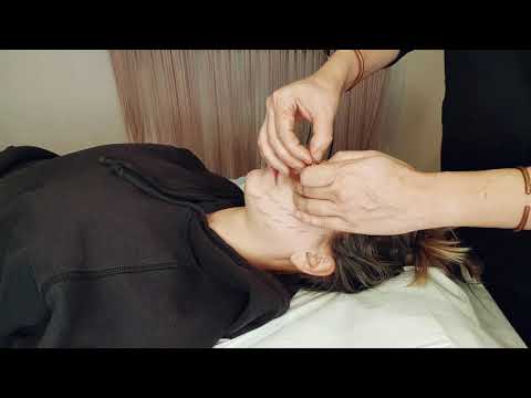 Jacina Acupuncture video.